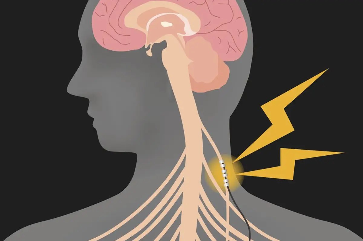 Dispozitivul „cât o multivitamină” care controlează poliartrita reumatoidă mai bine decât medicamentele. Totul a pornit de la o tragedie