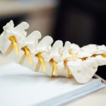 Afecțiuni osoase și spinale care pot apărea odată cu înaintarea în vârstă (P)