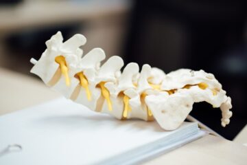 Afecțiuni osoase și spinale care pot apărea odată cu înaintarea în vârstă (P)