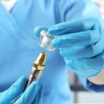 Ce include prețul unui implant dentar complet: De la consultatie la control final