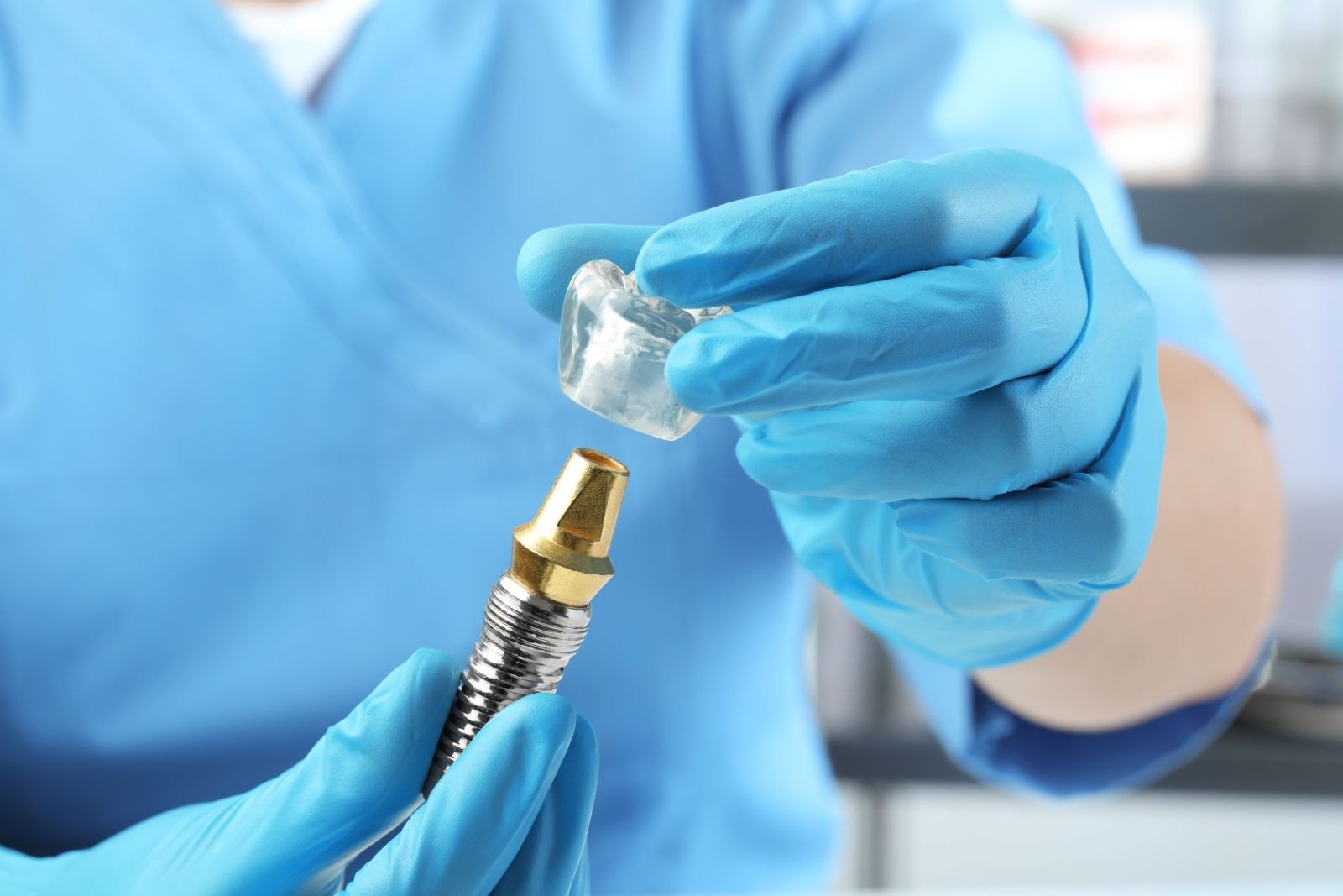 Ce include prețul unui implant dentar complet: De la consultatie la control final
