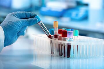 Revoltă după proiectul CNAS care ar putea bloca accesul bolnavilor la clinicile private: „Boala nu așteaptă. E o prostie”