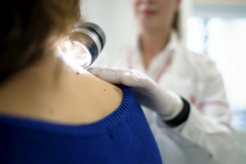 În București a fost deschis un centru dedicat diagnosticării și tratării melanomului