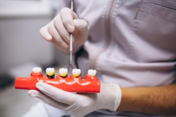 Poți beneficia de implant dentar dacă ai parodontoză?