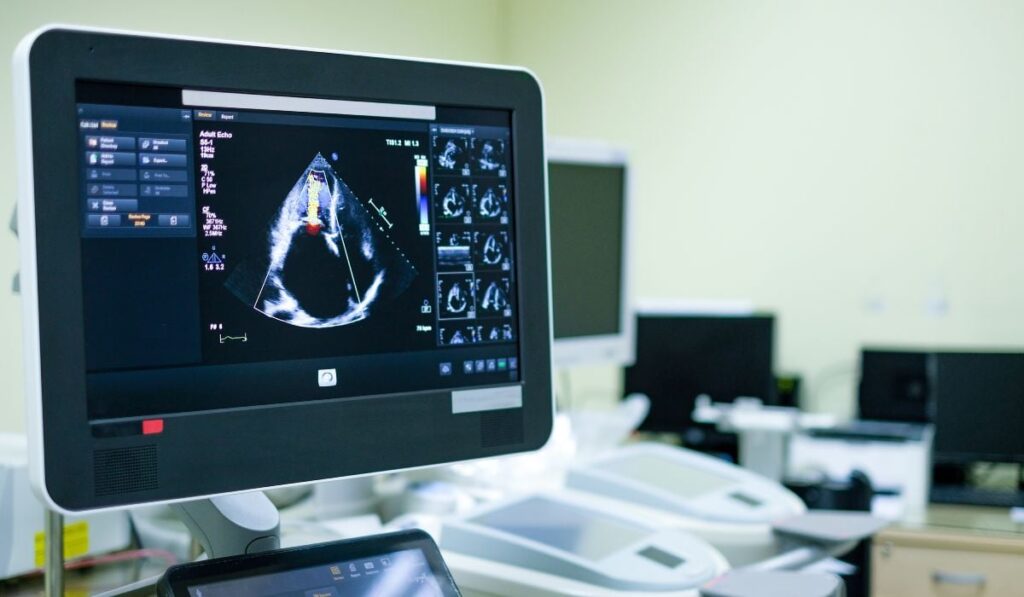 Aparatură de top de peste 350.000 de euro pentru Secția de Chirurgie Cardiovasculară de la Spitalul Marie Curie