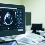 Aparatură de top de peste 350.000 de euro pentru Secția de Chirurgie Cardiovasculară de la Spitalul Marie Curie