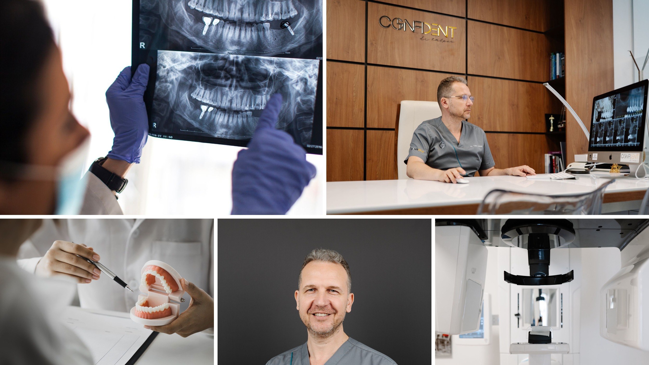 Cât durează un implant dentar și ce presupune fiecare etapă a tratamentului?
